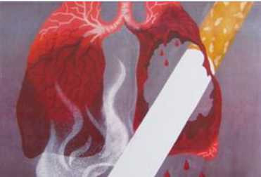 Hút thuốc lá sẽ bị ho thường xuyên đến mức mà người ta gọi là “ho thuốc lá”. Rất nhiều người chết do tâm phế mạn và khí thủng phổi