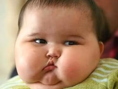 Khi trẻ đã bị béo phì thì cần phải tạo cho trẻ chế độ ăn thích hợp, tăng nhiều lượng rau quả, giảm tối đa lượng nước ngọt, đường bột và giảm dần khẩu phần ăn từ từ. Thường xuyên cho trẻ giải trí, vận động thể thao nhẹ cũng là một trong những biện pháp hữu hiệu để giúp trẻ giảm cân.