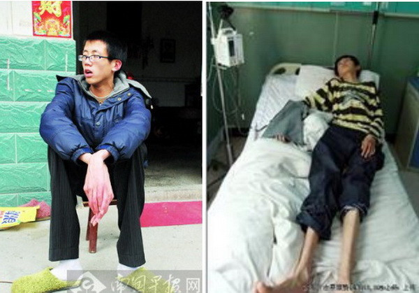 Khi Văn Tường vào học cấp 2, cơ thể của bạn ấy dần xuất hiện trạng thái bất ổn tim mạch. Văn Tường thường xuyên bị sốc sau mỗi vận động quá sức hay đột ngột.