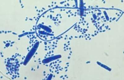 Nấm Trichophycon - Thủ phạm gây nấm móng.