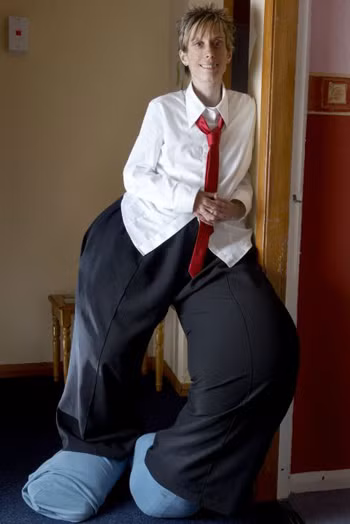 Để điều trị tật phù chân voi, phải sử dụng các thủ thuật nối mạch bạch huyết và tĩnh mạch, kết hợp với việc loại bỏ mô mỡ và mô xơ thừa dưới da, dẫn lưu tư thế và vật lý trị liệu … Khi bệnh đã phát triển đến độ nhất định thì cần phải tiến hành phẫu thuật để tránh những hậu họa về sau.