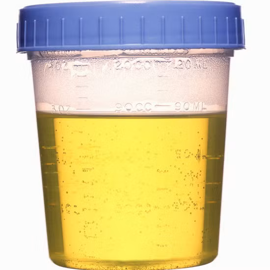 Việc sử dụng nước tiểu để chữa bệnh không chỉ được áp dụng cho người mà còn cho cả động vật. Ở đây, nước tiểu chính là nước thánh, cứu sống mọi sinh linh. Người uống "nước thánh" chữa bệnh phải ăn kiêng tuyệt đối như kiêng rượu bia, nước chè, kiêng mặn... chỉ được ăn nhạt, ăn hoa quả, uống thêm sữa... Khi uống nước giải thì không được uống thêm một loại thuốc nào khác, nếu uống thêm sẽ "tắc tử". Ngoài ra phải biết tin tưởng là sẽ khỏi bệnh (?). Tuy nhiên, theo nhiều nghiên cứu khoa học, nước tiểu lại tồn tại nhiều chất gây nguy hại tới sức khỏe và phương pháp chữa bệnh trên càng làm người bệnh vác thêm "đau yếu" mà thôi.