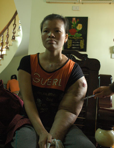 Thời gian vừa qua có lời đồn bà Phạm Thị Chanh ( ở thôn Viên Du, xã Thanh Vân, huyện Tam Dương, tỉnh Vĩnh Phúc) có khả năng chữa được bệnh ung thư và các căn bệnh nan y khác mà y học hiện đại phải bó tay, bằng một cách rất đơn giản. Bà chữa bệnh rất đơn giản đó là bắt tay và hát cho mọi người nghe. Khả năng chữa bệnh của cô Chanh được nhiều người biết đến.