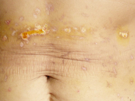 Một thầy khác tên Định cũng nổi danh chữa bệnh bằng cách đuổi tà ma (thầy ngụ tại xã Gia Lộc, huyện Trảng Bàng tỉnh Tây Ninh).“Thầy” chữa bệnh bằng cách cho bệnh nhân nằm xuống, đổ nước lã vào miệng, rồi dùng nhang đốt, chích vào người bà, kết hợp với việc… đấm đá túi bụi vào thân thể của bệnh nhân để… đuổi tà ma. Có những bệnh nhân bị chấn thương mà phải vào viện cấp cứu. Đúng là tiền mất tật mang... Một thầy khác tên Định cũng nổi danh chữa bệnh bằng cách đuổi tà ma (thầy ngụ tại xã Gia Lộc, huyện Trảng Bàng tỉnh Tây Ninh).“Thầy” chữa bệnh bằng cách cho bệnh nhân nằm xuống, đổ nước lã vào miệng, rồi dùng nhang đốt, chích vào người bà, kết hợp với việc… đấm đá túi bụi vào thân thể của bệnh nhân để… đuổi tà ma. Có những bệnh nhân bị chấn thương mà phải vào viện cấp cứu. Đúng là tiền mất tật mang...