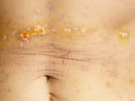 Một thầy khác tên Định cũng nổi danh chữa bệnh bằng cách đuổi tà ma (thầy ngụ tại xã Gia Lộc, huyện Trảng Bàng tỉnh Tây Ninh).“Thầy” chữa bệnh bằng cách cho bệnh nhân nằm xuống, đổ nước lã vào miệng, rồi dùng nhang đốt, chích vào người bà, kết hợp với việc… đấm đá túi bụi vào thân thể của bệnh nhân để… đuổi tà ma. Có những bệnh nhân bị chấn thương mà phải vào viện cấp cứu. Đúng là tiền mất tật mang...