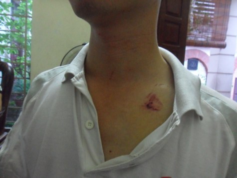 Nguyễn Tú Khôi cho biết những ngày gần đây nhà anh thường xuyên bị khủng bố. Nguyễn Tú Khôi cho biết những ngày gần đây nhà anh thường xuyên bị khủng bố.