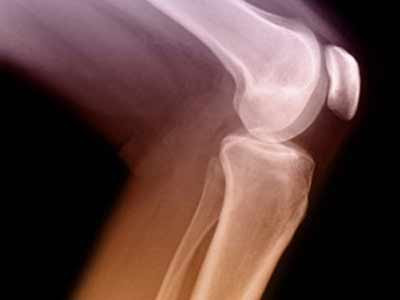 Thứ bảy là đầu gối: Đầu gối là một bộ phận của cơ thể rất dễ dàng bị bỏ qua, bởi không nhiều chị em ý thức được tầm quan trọng của nó. Ngoài việc cho bạn một đôi chân quyến rũ, đầu gối có khỏe mạnh thì mới giúp bạn đi lại tốt hơn. Thứ bảy là đầu gối: Đầu gối là một bộ phận của cơ thể rất dễ dàng bị bỏ qua, bởi không nhiều chị em ý thức được tầm quan trọng của nó. Ngoài việc cho bạn một đôi chân quyến rũ, đầu gối có khỏe mạnh thì mới giúp bạn đi lại tốt hơn.