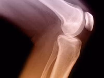 Thứ bảy là đầu gối: Đầu gối là một bộ phận của cơ thể rất dễ dàng bị bỏ qua, bởi không nhiều chị em ý thức được tầm quan trọng của nó. Ngoài việc cho bạn một đôi chân quyến rũ, đầu gối có khỏe mạnh thì mới giúp bạn đi lại tốt hơn. Thứ bảy là đầu gối: Đầu gối là một bộ phận của cơ thể rất dễ dàng bị bỏ qua, bởi không nhiều chị em ý thức được tầm quan trọng của nó. Ngoài việc cho bạn một đôi chân quyến rũ, đầu gối có khỏe mạnh thì mới giúp bạn đi lại tốt hơn.