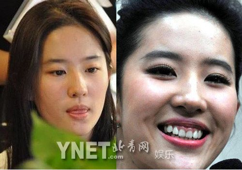 Lưu Diệc Phi dù nhận được nhiều lời khen về nhan sắc đẹp thơ ngây nhưng cô vẫn không thể tránh khỏi quy luật lão hóa của thời gian Lưu Diệc Phi dù nhận được nhiều lời khen về nhan sắc đẹp thơ ngây nhưng cô vẫn không thể tránh khỏi quy luật lão hóa của thời gian