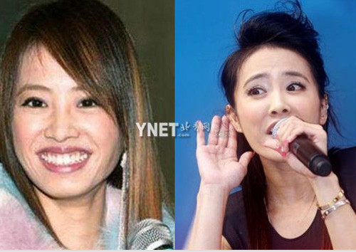 Thái Y Lâm cười rất tươi nhưng gương mặt nếp nhăn hai bên má cho thấy cô già đi nhiều Thái Y Lâm cười rất tươi nhưng gương mặt nếp nhăn hai bên má cho thấy cô già đi nhiều