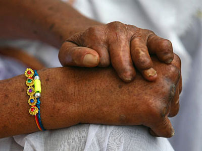 11 căn bệnh "tất yếu" của con người ảnh 3