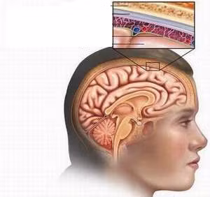 11. Viêm màng não: Viêm màng não mô cầu là một căn bệnh hiếm gặp nhưng nó có khả năng gây tử vong cao cho trẻ nhỏ. Trong khi đó, tỷ lệ trẻ được tiêm vắc-xin phòng bệnh lại khá thấp. Căn bệnh này lây lan chỉ cần qua một lần tiếp xúc với người bệnh và không thể chẩn đoán cũng như cứu chữa trong trường hợp phát hiện bệnh quá muộn. 11. Viêm màng não: Viêm màng não mô cầu là một căn bệnh hiếm gặp nhưng nó có khả năng gây tử vong cao cho trẻ nhỏ. Trong khi đó, tỷ lệ trẻ được tiêm vắc-xin phòng bệnh lại khá thấp. Căn bệnh này lây lan chỉ cần qua một lần tiếp xúc với người bệnh và không thể chẩn đoán cũng như cứu chữa trong trường hợp phát hiện bệnh quá muộn.