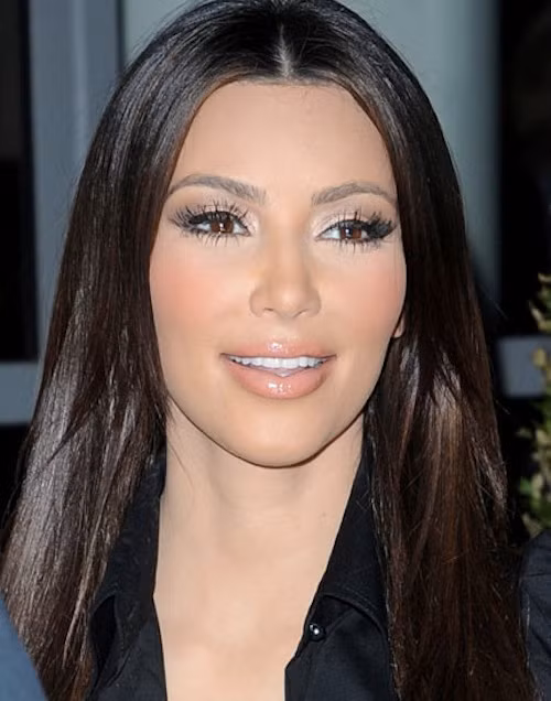 Gương mặt của Kim Kardashian cũng là một "thành quả" của botox.