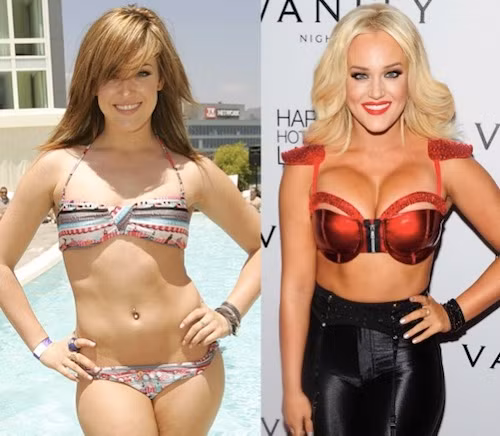 Bơm ngực, tiêm botox mang tới một vẻ gợi cảm mới cho Lachey Schwimmer. Tuy nhiên, các đường nét trên gương mặt cô trở nên thiếu tự nhiên hơn hẳn.