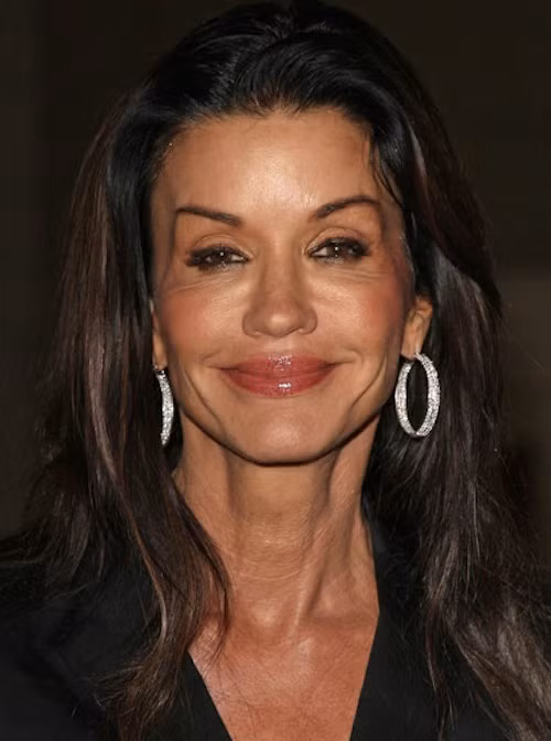 Đã bị cả tuổi già và botox tàn phá.