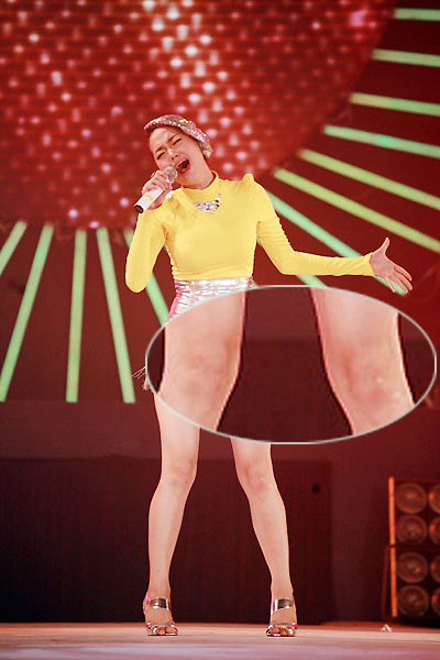 Mặc dù Minh Hằng sở hữu làn khá da trắng nhưng lại bị làm xấu bởi những vết sẹo.