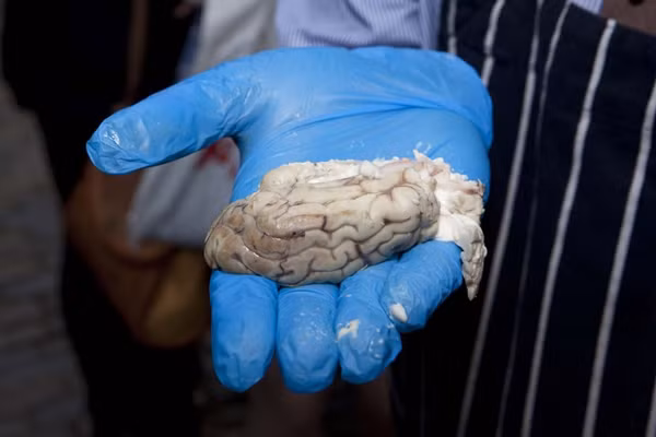 Những món ăn kỳ lạ nói trên đã thu hút sự tò mò của nhiều người. Một người dân địa phương, Molly Purcell cho biết: “Món não bê khá kỳ quặc nhưng mùi vị của nó cũng không đến nỗi nào”. Một người khác, anh Enrique Conmonzama nói thêm: “Mẹ tôi thường nấu não động vật cho tôi khi còn nhỏ. Có lẽ món ăn đó tốt cho sức khỏe con người”.