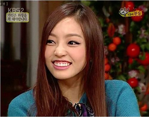 Cô ca sĩ trẻ Goo Hara của nhóm nhạc Kara cũng có kiểu cười hở lợi đặc trưng. Cô ca sĩ trẻ Goo Hara của nhóm nhạc Kara cũng có kiểu cười hở lợi đặc trưng.