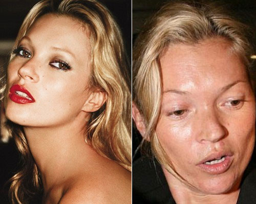 Kate Moss 38 tuổi nhưng trông gương mặt cô đầy nếp nhăn, mụn như bà già. Kate Moss 38 tuổi nhưng trông gương mặt cô đầy nếp nhăn, mụn như bà già.
