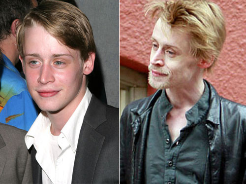 Ngôi sao phim "Ở nhà một mình" Macaulay Culkin ngày tàn tệ khiến nhiều người phải giật mình. Mới 32 tuổi nhưng khuôn mặt anh như một ông lão. Ngôi sao phim "Ở nhà một mình" Macaulay Culkin ngày tàn tệ khiến nhiều người phải giật mình. Mới 32 tuổi nhưng khuôn mặt anh như một ông lão.