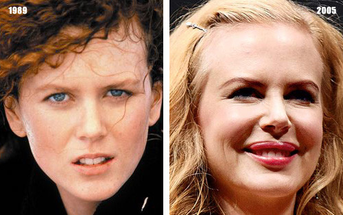 "Thiên nga Úc" Nicole Kidman muốn giữ vẻ quyến rũ cho mình bằng đôi môi căng mọng không tự nhiên. "Thiên nga Úc" Nicole Kidman muốn giữ vẻ quyến rũ cho mình bằng đôi môi căng mọng không tự nhiên.