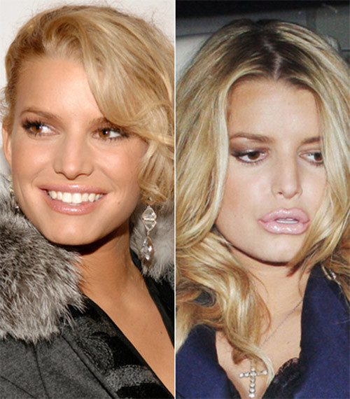 Cái bĩu môi không tự nhiên của Jessica Simpson. Cái bĩu môi không tự nhiên của Jessica Simpson.