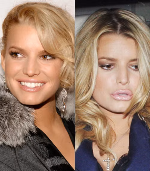 Cái bĩu môi không tự nhiên của Jessica Simpson.