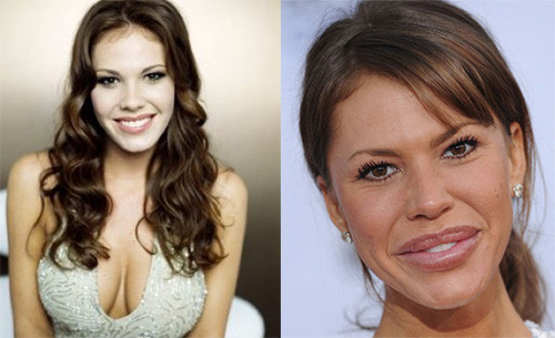 Nikki Cox và đôi môi dị dạng do dùng quá nhiều chất độn cho môi. Nikki Cox và đôi môi dị dạng do dùng quá nhiều chất độn cho môi.