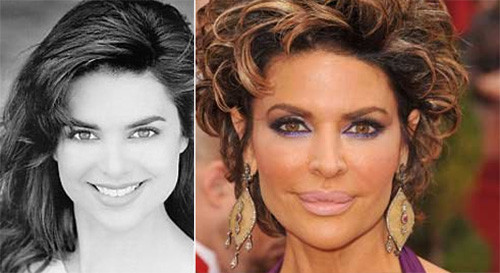 Liệu Lisa Rinna có tiếc thầm cho đôi môi đẹp của ngày xưa? Liệu Lisa Rinna có tiếc thầm cho đôi môi đẹp của ngày xưa?