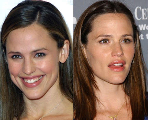 Jennifer Garner cũng muốn mình gợi cảm hơn bằng đôi môi dày. Jennifer Garner cũng muốn mình gợi cảm hơn bằng đôi môi dày.