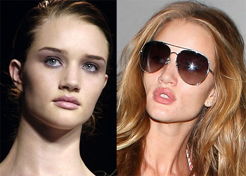 Cả gương mặt và đặc biệt là đôi môi của Rosie Huntington-Whiteley đã thực sự rơi vào tình trạng tồi tệ. Cả gương mặt và đặc biệt là đôi môi của Rosie Huntington-Whiteley đã thực sự rơi vào tình trạng tồi tệ.