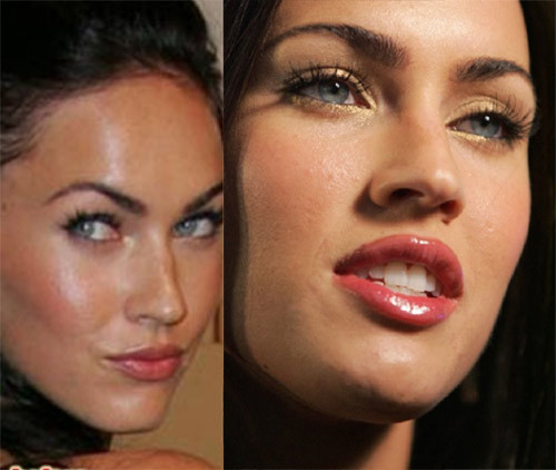 Megan Fox liên tục bị phát hiện đi bơm môi. Megan Fox liên tục bị phát hiện đi bơm môi.