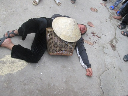 Bà Bình sau khi bị Hoàng Thế Anh đánh chảy máu và ngất vào sáng ngày 23/1 Bà Bình sau khi bị Hoàng Thế Anh đánh chảy máu và ngất vào sáng ngày 23/1