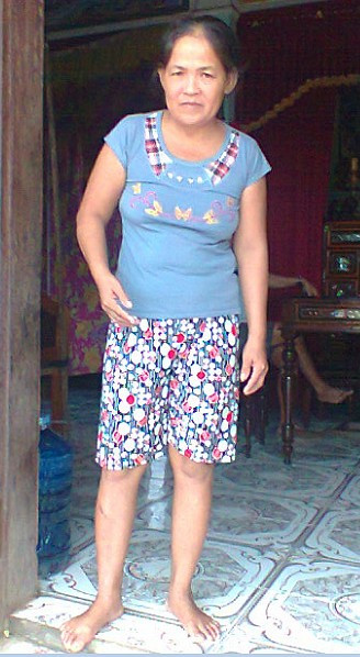 Bị tai nạn giao thông, sau ba ngày bất tỉnh, chị Nguyễn Thị Thảo ( quê tại tỉnh Quảng Bình) tỉnh dậy và chỉ nói giọng Bắc. Theo như mọi người ở đây nói trước khi bị tai nạn, chị Thảo vẫn nói giọng đặc sệt của địa phương Nghĩa Ninh- Quảng Bình. Gia đình chị rất khó chịu vì sự thay đổi này và hoang mang không biết chị mắc căn bệnh kỳ lạ gì. Dù chưa có cơ hội gặp người Bắc nhưng không hiểu sao, chị lại biết ngôn ngữ của người ngoài Bắc. Theo các bác sỹ có thể nguyên nhân là do rối loạn tâm lý. Vì vậy chị cần được điều trị tâm lý để điều chỉnh lại những xáo trộn trong đầu.