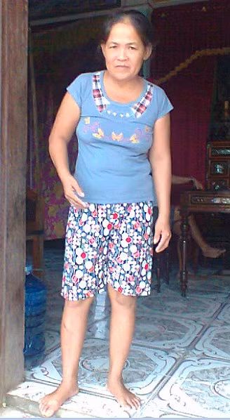 Bị tai nạn giao thông, sau ba ngày bất tỉnh, chị Nguyễn Thị Thảo ( quê tại tỉnh Quảng Bình) tỉnh dậy và chỉ nói giọng Bắc. Theo như mọi người ở đây nói trước khi bị tai nạn, chị Thảo vẫn nói giọng đặc sệt của địa phương Nghĩa Ninh- Quảng Bình. Gia đình chị rất khó chịu vì sự thay đổi này và hoang mang không biết chị mắc căn bệnh kỳ lạ gì. Dù chưa có cơ hội gặp người Bắc nhưng không hiểu sao, chị lại biết ngôn ngữ của người ngoài Bắc. Theo các bác sỹ có thể nguyên nhân là do rối loạn tâm lý. Vì vậy chị cần được điều trị tâm lý để điều chỉnh lại những xáo trộn trong đầu.