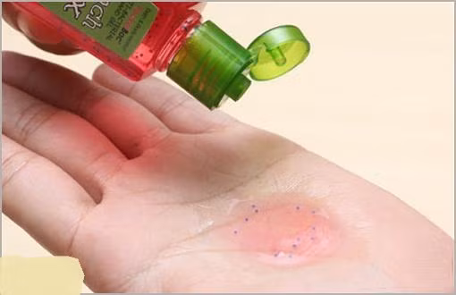 1. Sử dụng gel rửa tay: Nếu bạn thường xuyên sủ dụng gel rửa tay thì bạn thì nên thay đổi thói quen này và hạn chế dùng chúng trừ khi bạn đang ở trong một nơi đặc biệt dễ bị lây bệnh như bệnh viện…