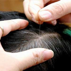 5. Tóc: Các nang tóc trở nên ít hơn và tóc bắt đầu mọc chậm, vì thế đàn ông có xu hướng mỏng tóc trên đỉnh đầu, một số khác thì hói hẳn. 5. Tóc: Các nang tóc trở nên ít hơn và tóc bắt đầu mọc chậm, vì thế đàn ông có xu hướng mỏng tóc trên đỉnh đầu, một số khác thì hói hẳn.