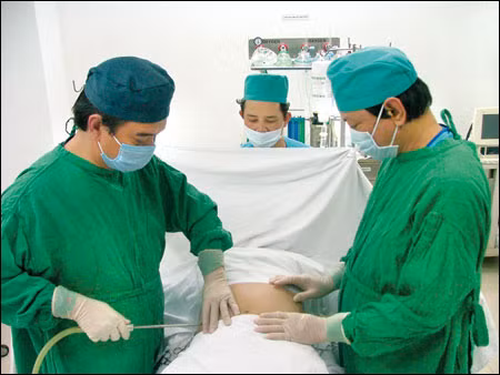 3. Tỷ lệ mỡ: Tỷ lệ mỡ ở đàn ông tăng gấp đôi giữa tuổi 25 và 75, hầu hết chất béo phân bố ở các nội tạng và bó cơ. 3. Tỷ lệ mỡ: Tỷ lệ mỡ ở đàn ông tăng gấp đôi giữa tuổi 25 và 75, hầu hết chất béo phân bố ở các nội tạng và bó cơ.