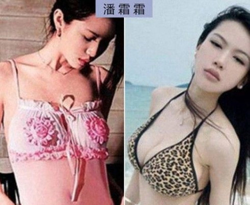 Bồ cũ của Lâm Phong, Phan Sương Sương nổi tiếng với đôi gò bồng đào căng tròn nhưng cô cũng từng phải đi thẩm mỹ để thay đổi kích cỡ đáng kể vòng ngực. Bồ cũ của Lâm Phong, Phan Sương Sương nổi tiếng với đôi gò bồng đào căng tròn nhưng cô cũng từng phải đi thẩm mỹ để thay đổi kích cỡ đáng kể vòng ngực.