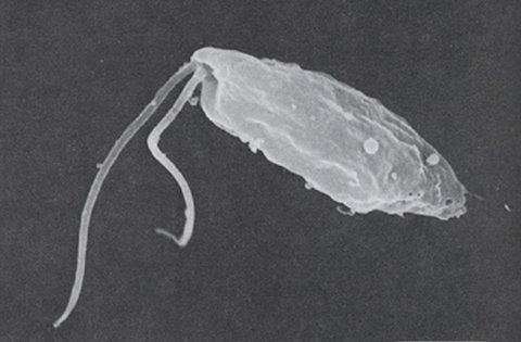 Hình ảnh amip ăn não người qua kính hiển vi (Ảnh: Lao động) Hình ảnh amip ăn não người qua kính hiển vi (Ảnh: Lao động)