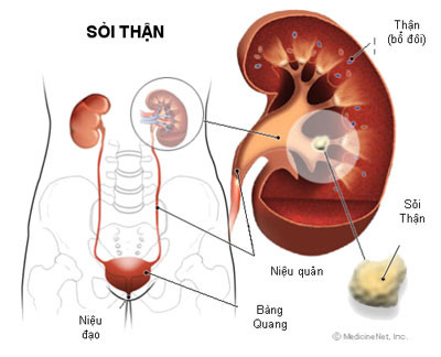 Bệnh thận: Tránh canxi, dù bị bất kỳ loại bệnh gì liên quan đến thận, bạn cần loại canxi khỏi danh sách bổ sung. Uống canxi trên 700 mg mỗi ngày có thể dẫn tới lắng đọng khoáng chất này trong thận, lâu ngày trở thành sỏi thận. Bệnh thận: Tránh canxi, dù bị bất kỳ loại bệnh gì liên quan đến thận, bạn cần loại canxi khỏi danh sách bổ sung. Uống canxi trên 700 mg mỗi ngày có thể dẫn tới lắng đọng khoáng chất này trong thận, lâu ngày trở thành sỏi thận.