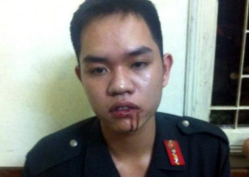 Đồng chí Nguyễn Văn Sang chưa hết bất ngờ về sự manh động của nữ sinh viên này kể lại: “Đang yêu cầu và giải thích cho cô ấy chấp hành theo đúng pháp luật, nhưng bất ngờ, cô gái đấm thẳng vào miệng, khiến tôi choáng váng ngã xuống”. (Ảnh: Đồng chí Nguyễn Văn Sang sau khi bị nữ sinh viên hành hung). Đồng chí Nguyễn Văn Sang chưa hết bất ngờ về sự manh động của nữ sinh viên này kể lại: “Đang yêu cầu và giải thích cho cô ấy chấp hành theo đúng pháp luật, nhưng bất ngờ, cô gái đấm thẳng vào miệng, khiến tôi choáng váng ngã xuống”. (Ảnh: Đồng chí Nguyễn Văn Sang sau khi bị nữ sinh viên hành hung).