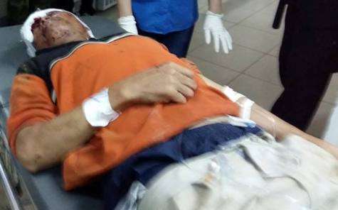 Nạn nhân Phạm Văn Xô vẫn chưa hết bàng hoàng sau khi bị khối giàn giáo hàng trăm tấn đổ ập xuống người (ảnh Xuân Hòa)