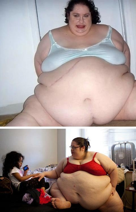 2. Donna Simpson: Donna Simpson (sinh năm 1967) là người phụ nữ năm 2008 từng bày tỏ ý định trở thành một trong những cô nàng nặng cân nhất thế giới. Cô từng ao ước mình sẽ nặng tới 450kg. Tuy nhiên, tính đến tháng 6/2010, cô Simpson chỉ nặng 273kg, giảm so với mức cân nặng 290kg của cô năm 2008. Trong suốt quá trình này, Simpson duy trì một website để những người hâm mộ trả tiền để được xem cô ăn. Năm 2010, cô được Sách Kỷ lục Guinness thế giới vinh danh là “người phụ nữ nặng nhất thế giới sinh con”. Xem thêm: Lạ lùng người phụ nữ khóc ra 'kim cương' / Trẻ béo phì dễ mắc ung thư gan khi trưởng thành / Bệnh lạ: Cô gái sau hôn mê bỗng trở thành... người đồng tính 2. Donna Simpson: Donna Simpson (sinh năm 1967) là người phụ nữ năm 2008 từng bày tỏ ý định trở thành một trong những cô nàng nặng cân nhất thế giới. Cô từng ao ước mình sẽ nặng tới 450kg. Tuy nhiên, tính đến tháng 6/2010, cô Simpson chỉ nặng 273kg, giảm so với mức cân nặng 290kg của cô năm 2008. Trong suốt quá trình này, Simpson duy trì một website để những người hâm mộ trả tiền để được xem cô ăn. Năm 2010, cô được Sách Kỷ lục Guinness thế giới vinh danh là “người phụ nữ nặng nhất thế giới sinh con”. Xem thêm: Lạ lùng người phụ nữ khóc ra 'kim cương' / Trẻ béo phì dễ mắc ung thư gan khi trưởng thành / Bệnh lạ: Cô gái sau hôn mê bỗng trở thành... người đồng tính