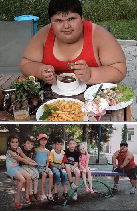 10. Một cậu bé 11 tuổi có tên Dzhambik Khatokhov (thường gọi là Jambik) đến từ Kabardino-Balkaria, Nga, nặng 147kg và cao 1m57 được coi là đứa trẻ béo nhất thế giới. Khi chào đời, Jambik cân nặng 2,9kg – mức chấp nhận được đối với một trẻ sơ sinh, nhưng đến ngày sinh nhật 1 tuổi, cậu bé đã nặng hơn 12,7kg. Lúc 3 tuổi, Jambik tăng thêm 3kg nhưng đến khi 4 tuổi đã đạt tới mức cân nặng đột biến là 36,7kg, mặc dù chỉ cao 1m19. Và đến khi 6 tuổi, cậu đã nặng 71,2kg. Kể từ đó, Jambik tiếp tục tăng thêm gần 50,8kg do ăn nhiều cháo đặc và kem. Xem thêm: Lạ lùng người phụ nữ khóc ra 'kim cương' / Trẻ béo phì dễ mắc ung thư gan khi trưởng thành / Bệnh lạ: Cô gái sau hôn mê bỗng trở thành... người đồng tính 10. Một cậu bé 11 tuổi có tên Dzhambik Khatokhov (thường gọi là Jambik) đến từ Kabardino-Balkaria, Nga, nặng 147kg và cao 1m57 được coi là đứa trẻ béo nhất thế giới. Khi chào đời, Jambik cân nặng 2,9kg – mức chấp nhận được đối với một trẻ sơ sinh, nhưng đến ngày sinh nhật 1 tuổi, cậu bé đã nặng hơn 12,7kg. Lúc 3 tuổi, Jambik tăng thêm 3kg nhưng đến khi 4 tuổi đã đạt tới mức cân nặng đột biến là 36,7kg, mặc dù chỉ cao 1m19. Và đến khi 6 tuổi, cậu đã nặng 71,2kg. Kể từ đó, Jambik tiếp tục tăng thêm gần 50,8kg do ăn nhiều cháo đặc và kem. Xem thêm: Lạ lùng người phụ nữ khóc ra 'kim cương' / Trẻ béo phì dễ mắc ung thư gan khi trưởng thành / Bệnh lạ: Cô gái sau hôn mê bỗng trở thành... người đồng tính