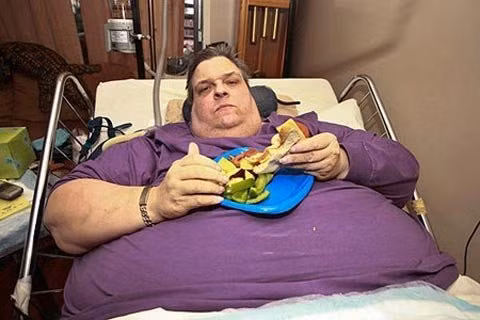 6. Michael Hebranko: Michael Hebranko (sinh ngày 14/5/1953) – một trong những người nặng cân nhất thế giới là ca béo bệnh nghiêm trọng nhất. Sau quá trình điều trị ở bệnh viện St. Luke ở New York, Mỹ, ông giảm từ 411kg xuống còn 90kg và vòng eo từ 290cm xuống còn 91cm trong 19 tháng, với sự hỗ trợ của một huấn luyện viên thể dục và chế độ ăn kiêng nghiêm ngặt. Điều kỳ diệu này đã giúp Hebranko có được kỷ lục Guinness thế giới về “giảm cân nhiều nhất” vào năm 1990. Về sau, ông đi khắp nước Mỹ để diễn thuyết về kinh nghiệm của mình cũng như cổ vũ cho việc tập luyện thể dục thể thao và ăn kiêng. Xem thêm: Lạ lùng người phụ nữ khóc ra 'kim cương' / Trẻ béo phì dễ mắc ung thư gan khi trưởng thành / Bệnh lạ: Cô gái sau hôn mê bỗng trở thành... người đồng tính 6. Michael Hebranko: Michael Hebranko (sinh ngày 14/5/1953) – một trong những người nặng cân nhất thế giới là ca béo bệnh nghiêm trọng nhất. Sau quá trình điều trị ở bệnh viện St. Luke ở New York, Mỹ, ông giảm từ 411kg xuống còn 90kg và vòng eo từ 290cm xuống còn 91cm trong 19 tháng, với sự hỗ trợ của một huấn luyện viên thể dục và chế độ ăn kiêng nghiêm ngặt. Điều kỳ diệu này đã giúp Hebranko có được kỷ lục Guinness thế giới về “giảm cân nhiều nhất” vào năm 1990. Về sau, ông đi khắp nước Mỹ để diễn thuyết về kinh nghiệm của mình cũng như cổ vũ cho việc tập luyện thể dục thể thao và ăn kiêng. Xem thêm: Lạ lùng người phụ nữ khóc ra 'kim cương' / Trẻ béo phì dễ mắc ung thư gan khi trưởng thành / Bệnh lạ: Cô gái sau hôn mê bỗng trở thành... người đồng tính