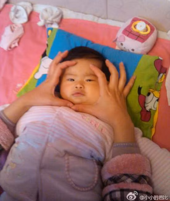 Mẹ Tiểu Miễn thường xuyên đăng tải ảnh của bé lên mạng. Đôi khi, cô khéo léo che phần mặt có u cho con gái. Xem thêm: Hình ảnh về những căn bệnh quái dị nhất trên thế giới (P4) / Hình ảnh về những căn bệnh quái dị nhất trên thế giới (P1)