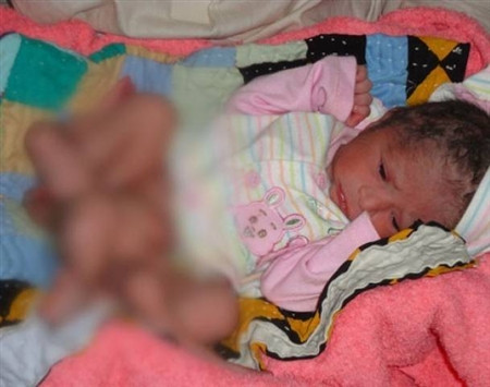 Gia đình bé sáu chân đang kêu gọi sự giúp đỡ của các nhà hảo tâm. .