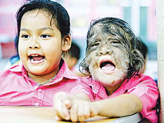 Cô bé chia sẻ với báo chí: "Cháu rất hạnh phúc khi được ghi danh trong kỷ lục Guinness thế giới. Rất nhiều người đã phải cố gắng để được ghi danh trong sách kỷ lục. Tất cả những gì cháu đã làm là trả lời một số câu hỏi và sau đó họ ghi danh cháu vào". Xem thêm: Phát hoảng với những thân hình "khủng" nhất thế giới do ăn nhiều / Những hình ảnh thương tâm về căn bệnh 'lạ' ở Quảng Ngãi