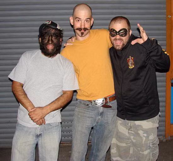 Jesús Aceves được sinh ra tại Loreto, Mexico. Do bộ mặt của anh bao phủ đầy lông mà mọi người gọi anh là "người đàn ông khỉ". Anh đã kết hôn và có hai con gái, một trong hai người con cũng mắc phải bệnh mọc lông giống anh. Xem thêm: Phát hoảng với những thân hình "khủng" nhất thế giới do ăn nhiều / Những hình ảnh thương tâm về căn bệnh 'lạ' ở Quảng Ngãi